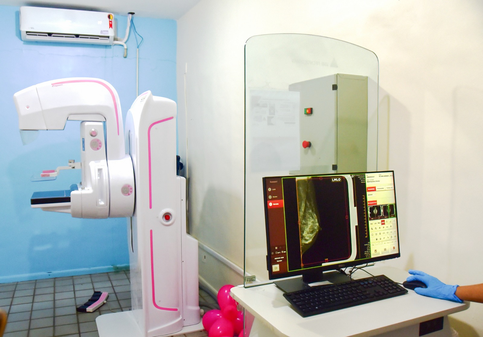 imagem colorida da sala de exame. Ao centro é visto a maquina de mamografia e ao lado direito um computador.